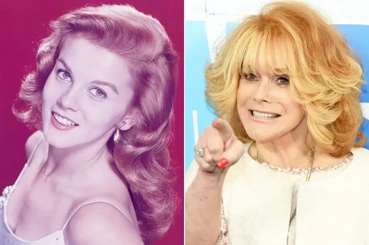 Ann-Margret, Born In 1941 – 80 Years Old