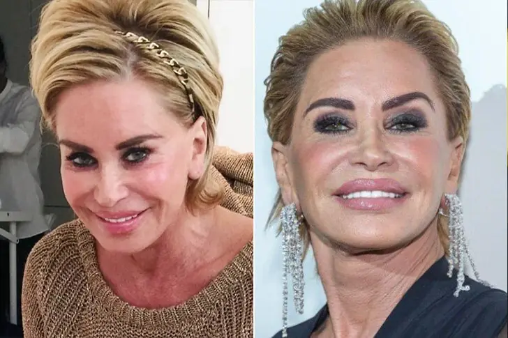 CONNIE BREUKHOVEN – VANESSA