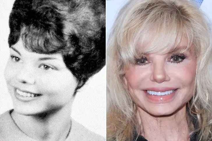 Loni Anderson – Age 75