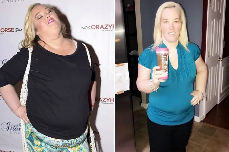 Mama June – Lost 300 Pounds Through Life-Altering Treatment