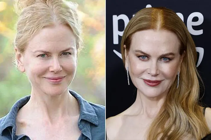 NICOLE KIDMAN – ZANGERES