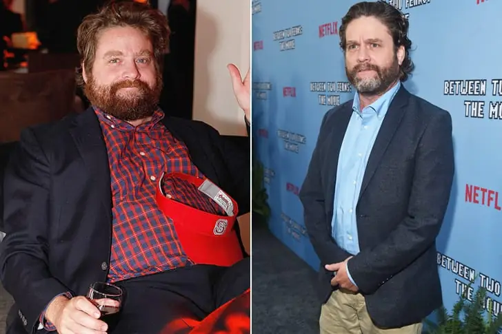 Zach Galifianakis – Lost 50 Pounds By Cutting Out Alcohol And Walking
