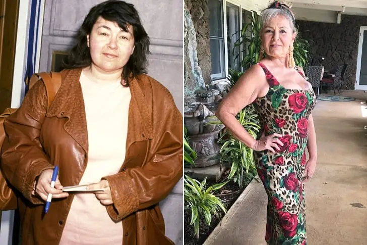 Roseanne Barr – Lost 100 Pounds By Having Gastric Bypass Surgery