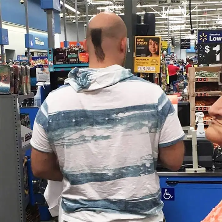 Balding Ponytail Boldness