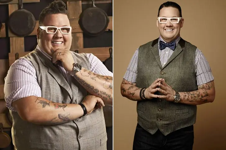 Graham Elliot – Lost 147 Pounds Through Health-Related Treatments