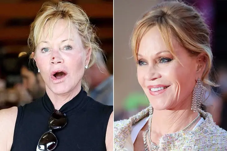 Melanie Griffith