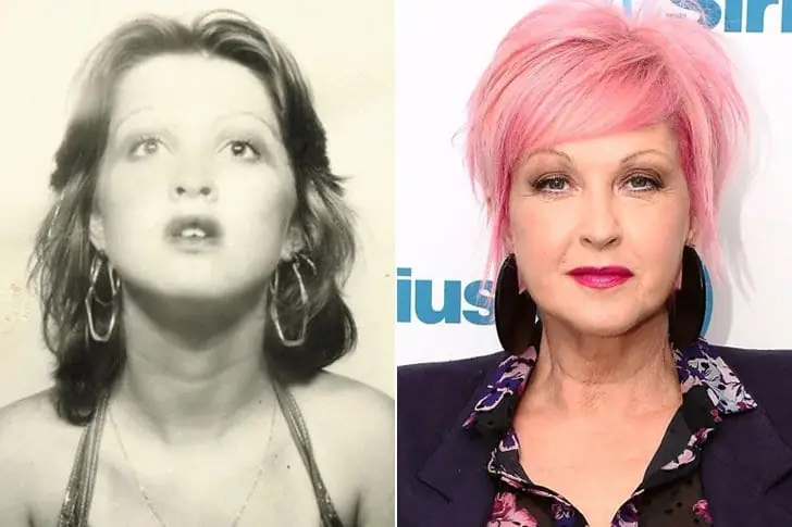 Cyndi Lauper – 67 Years Old