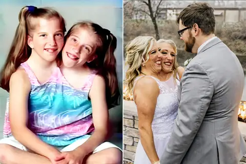 These Twins Prove Nothing Is Impossible—Even When You Share Only One Body!