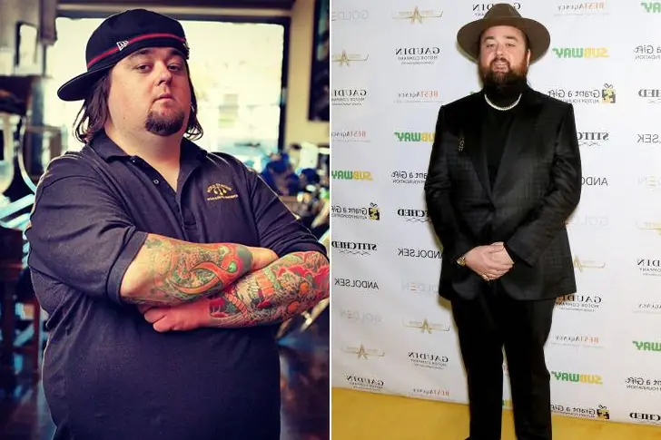 Chumlee – Lost 130 Pounds By Having A Life-Changing Procedure