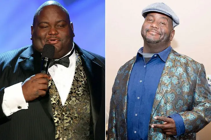 Lavell Crawford – Lost 120 Pounds By Undergoing Life-Changing Procedures