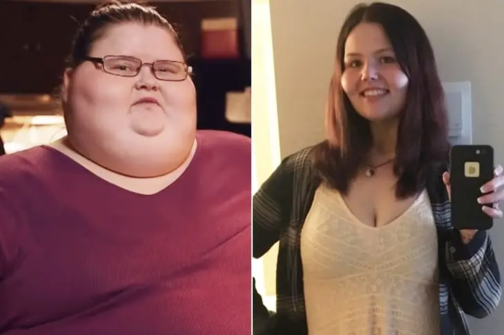Ashley Dunn – Lost 350 Pounds By Getting Gastric Bypass Surgery