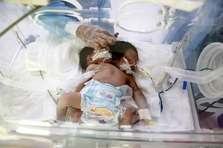 The Extraordinary World of Twins