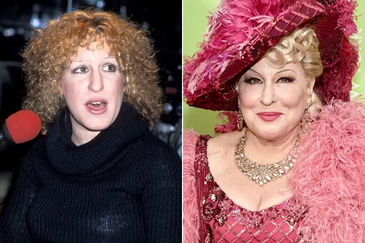 Bette Midler, Born In 1945 – 75 Years Old