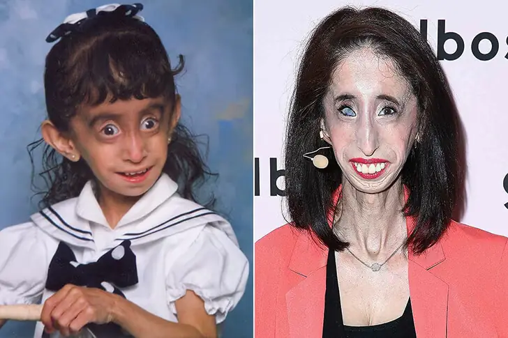 Lizzie Velásquez
