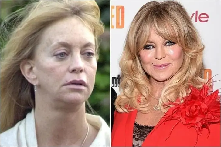 Goldie Hawn – Die Oscargewinnerin